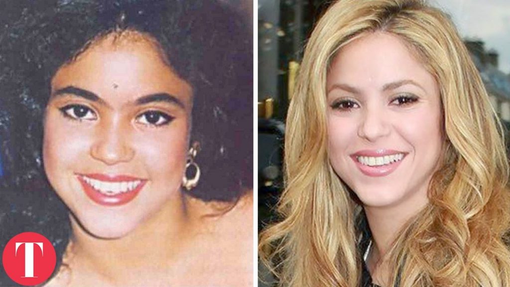 10 Hot Celebs who used to be Ugly Ducklings