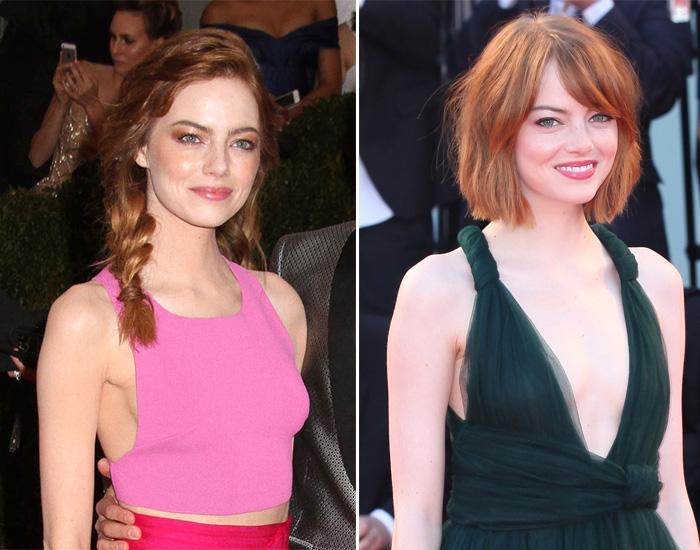 Best and Worst Celebrity Transformations