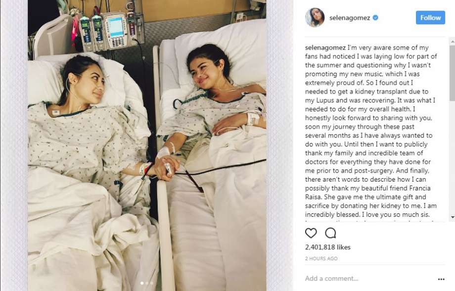 Selena Gomez undergoes Kidney Transplant due to Lupus