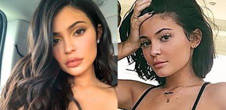 Kylie Jenner REMOVES Lip Fillers & Posts Natural Photo