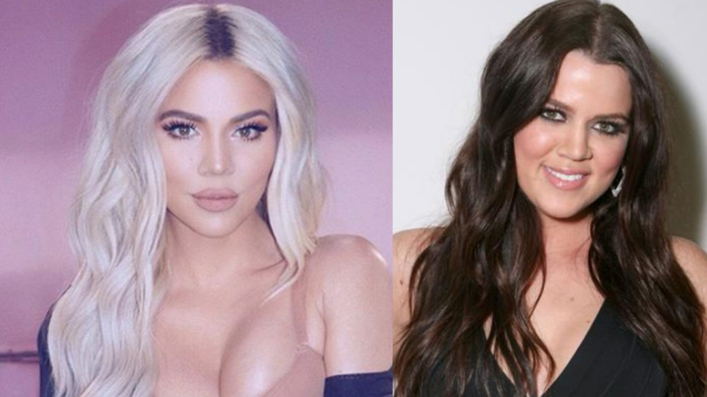 Khloe Kardashian is addicted to Plastic Surgery & Family is concerned!