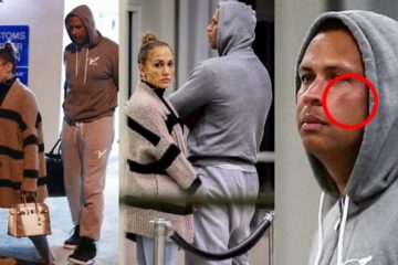 Jennifer Lopez’s new fiancé Alex Rodriguez appears to have a bruised face as couple arrive in Miami