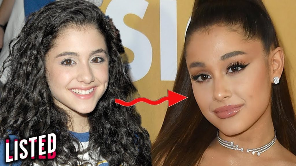 9 Best Celebrity Glow-Ups